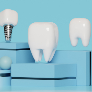 ИМПЛАНТАЦИЯ + ОРТОПЕДИЯ